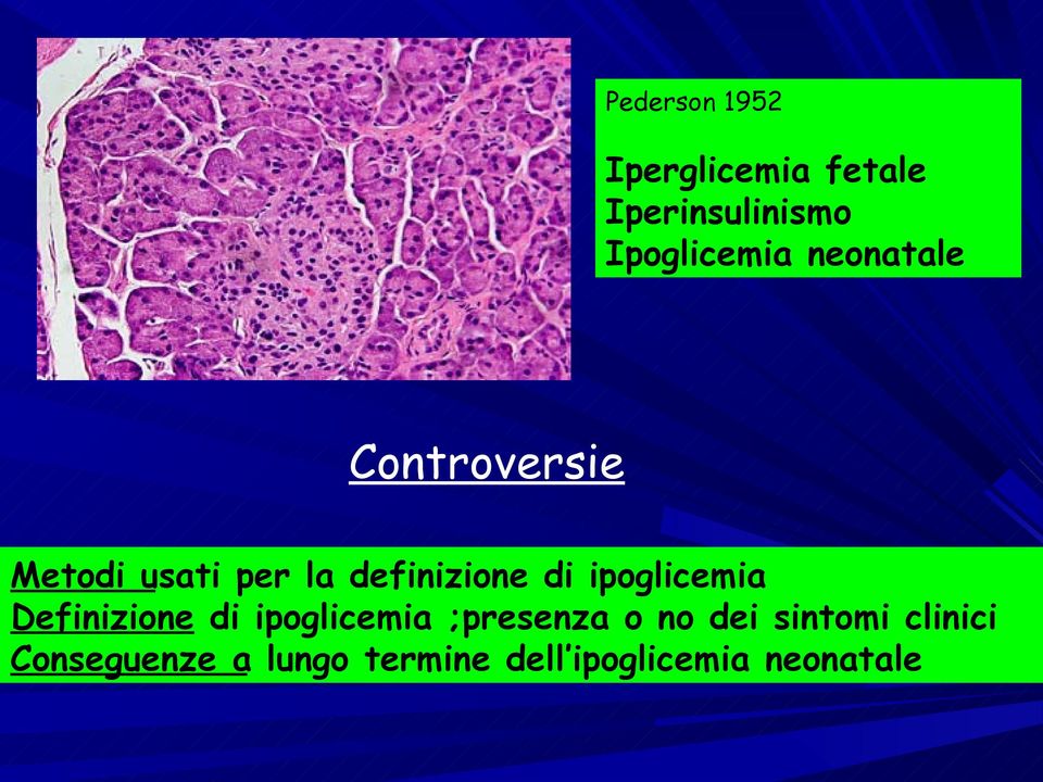 ipoglicemia Definizione di ipoglicemia ;presenza o no dei