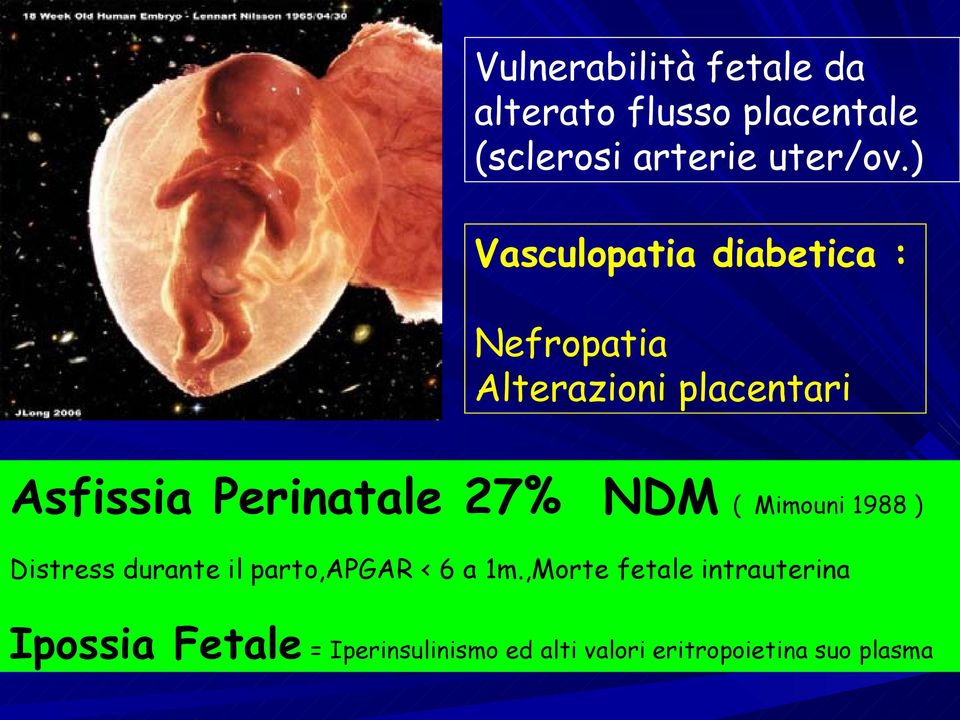 27% NDM ( Mimouni 1988 ) Distress durante il parto,apgar < 6 a 1m.