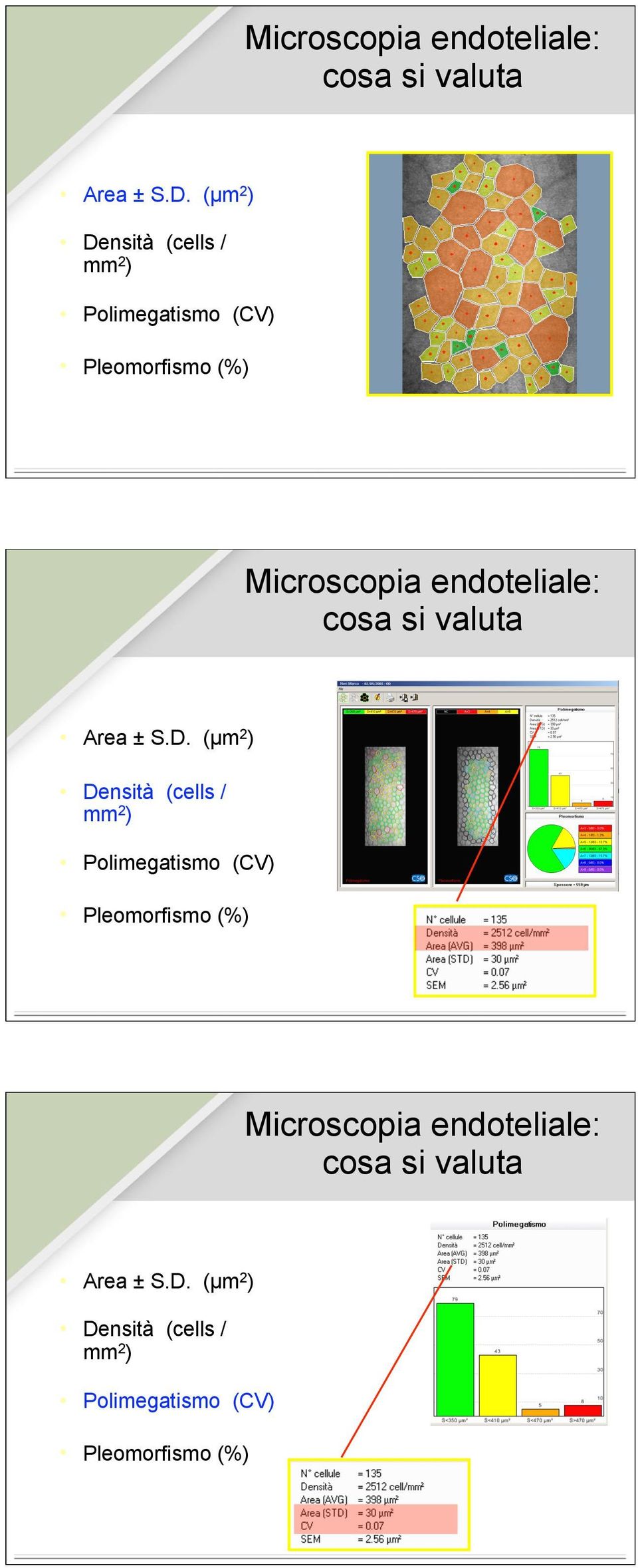 (µm 2 ) Densità (cells / mm 2 ) Polimegatismo (CV) Pleomorfismo (%)