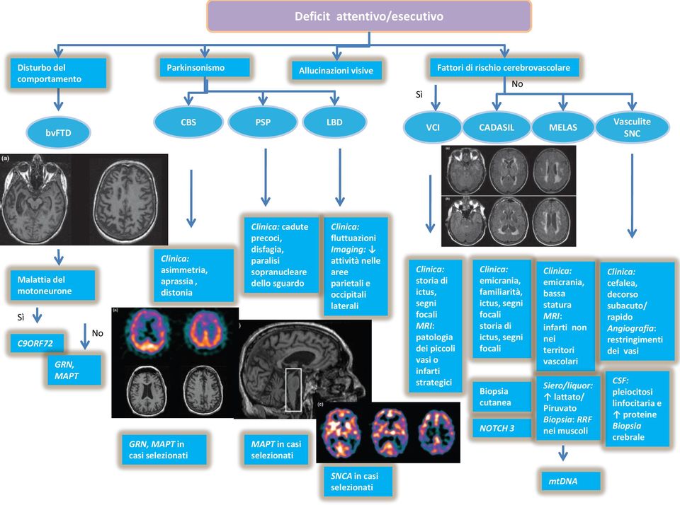 selezionati Clinica: fluttuazioni Imaging: attività nelle aree parietali e occipitali laterali Clinica: storia di ictus, segni focali MRI: patologia dei piccoli vasi o infarti strategici Clinica: