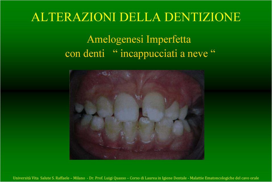 con denti