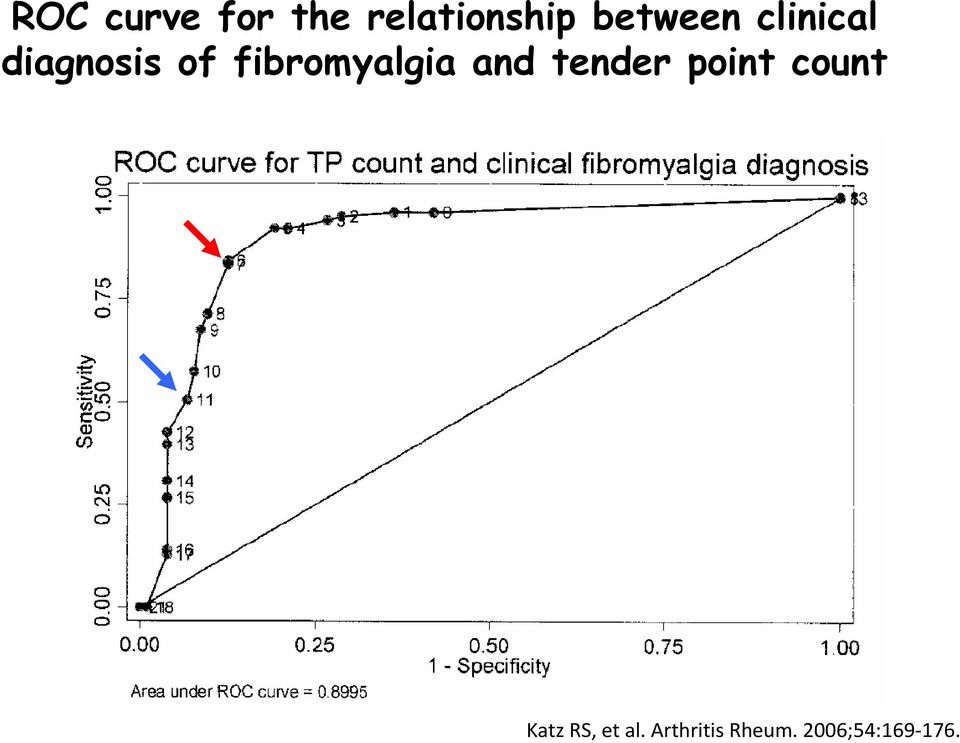 fibromyalgia and tender point count