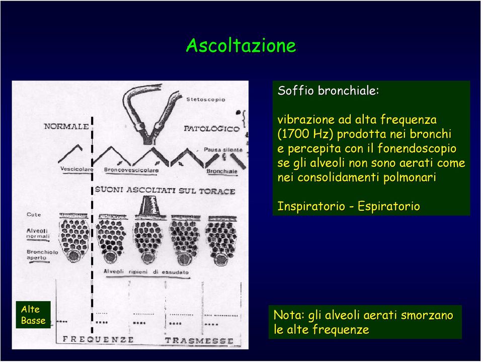 alveoli non sono aerati come nei consolidamenti polmonari