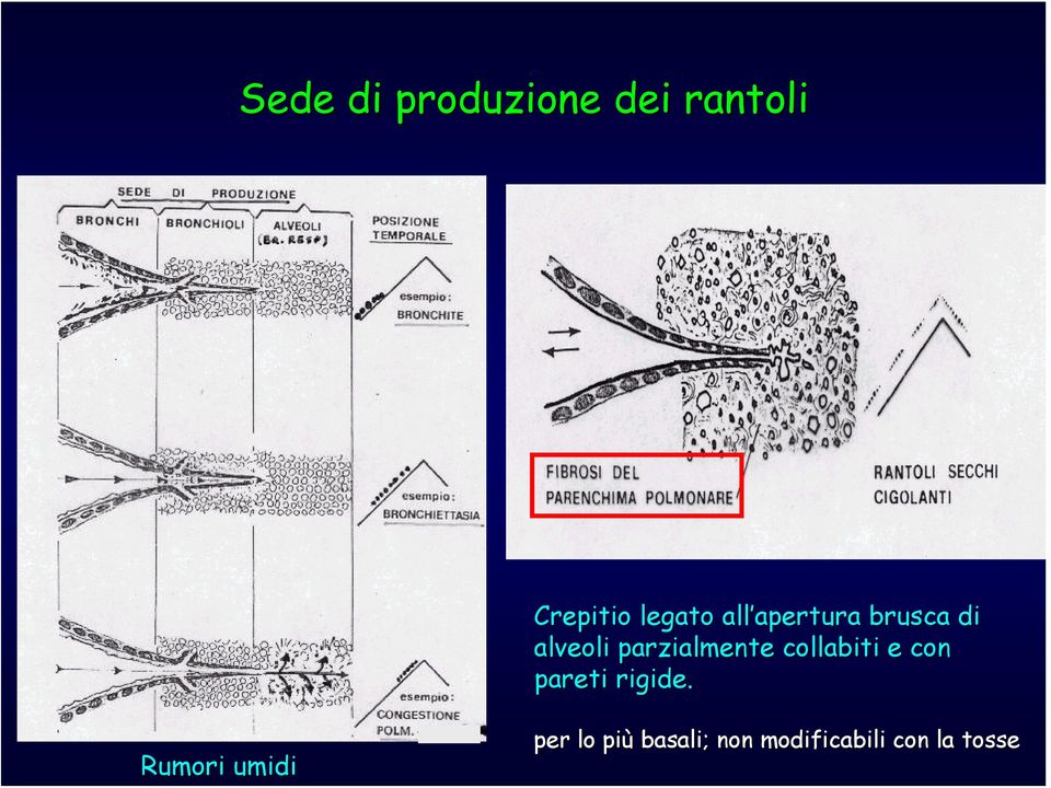 parzialmente collabiti e con pareti rigide.