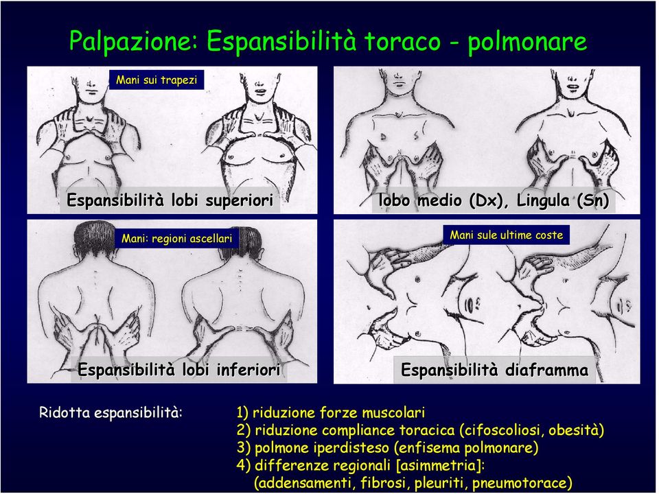 espansibilità: 1) riduzione forze muscolari 2) riduzione compliance toracica (cifoscoliosi( cifoscoliosi,, obesità) 3)