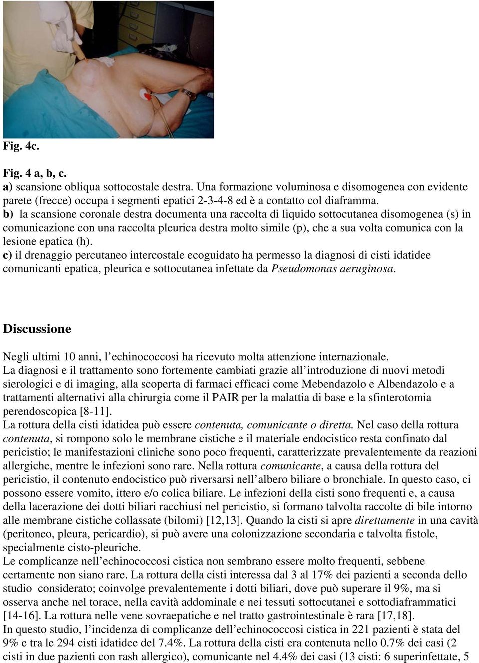 lesione epatica (h). c) il drenaggio percutaneo intercostale ecoguidato ha permesso la diagnosi di cisti idatidee comunicanti epatica, pleurica e sottocutanea infettate da Pseudomonas aeruginosa.