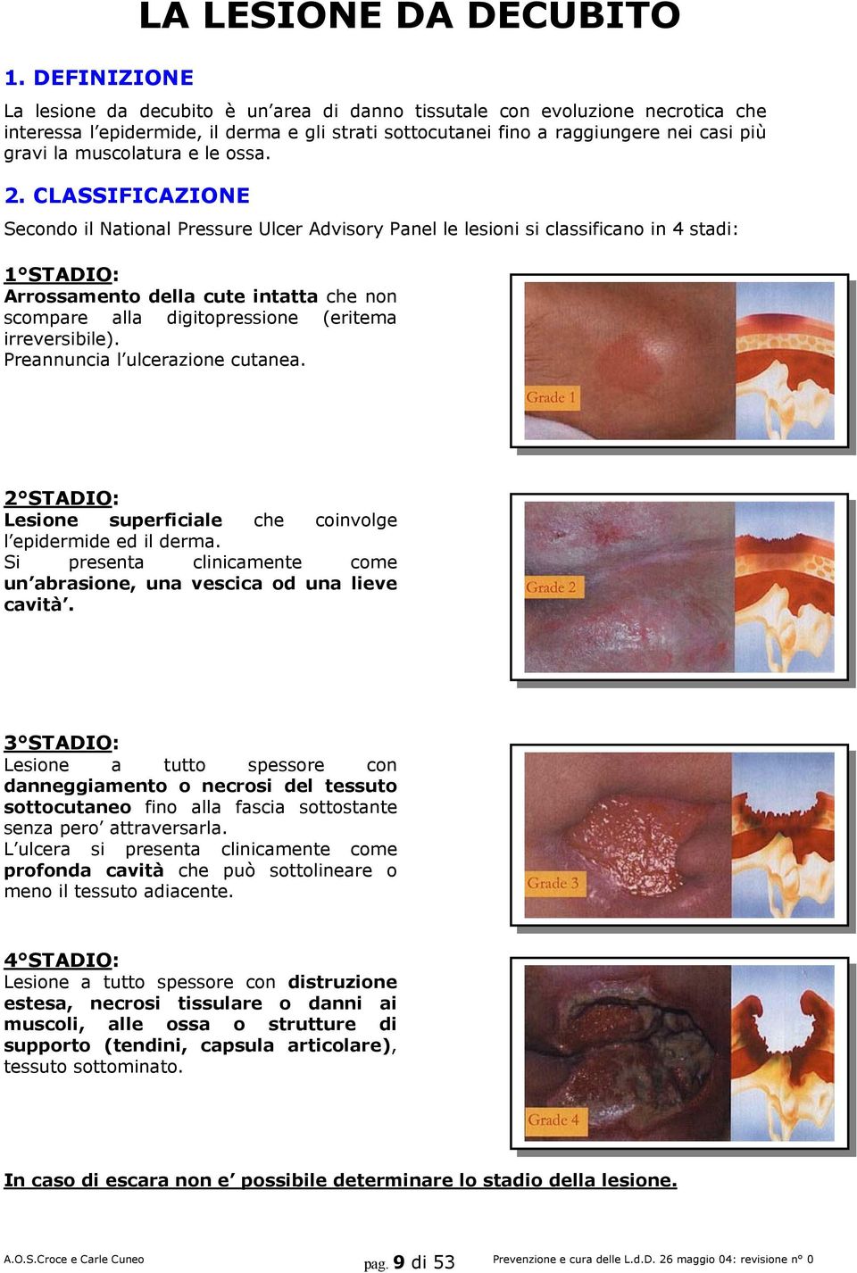 CLASSIFICAZIONE Secondo il National Pressure Ulcer Advisory Panel le lesioni si classificano in 4 stadi: 1 STADIO: Arrossamento della cute intatta che non scompare alla digitopressione (eritema