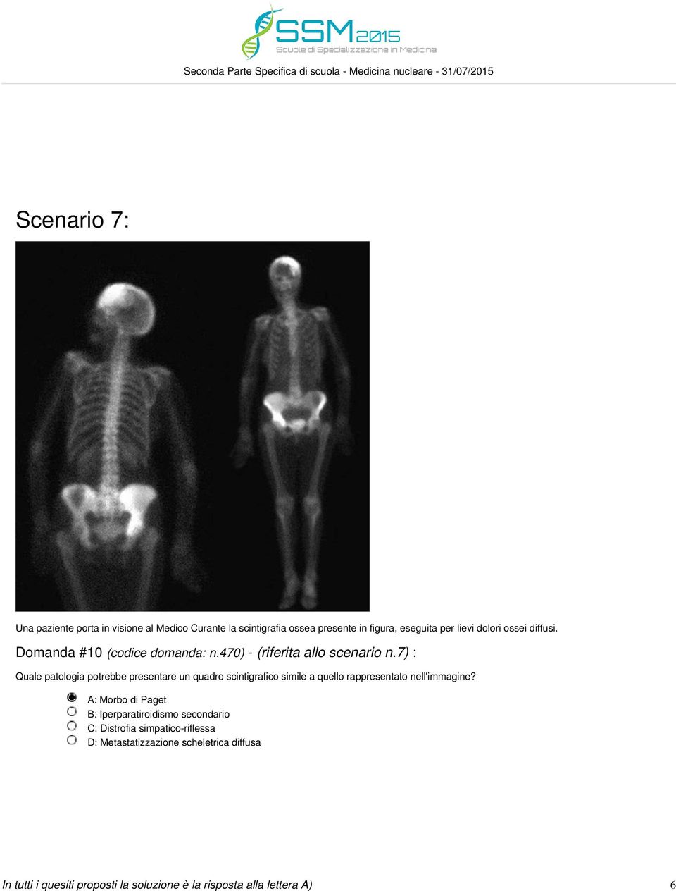 7) : Quale patologia potrebbe presentare un quadro scintigrafico simile a quello rappresentato nell'immagine?