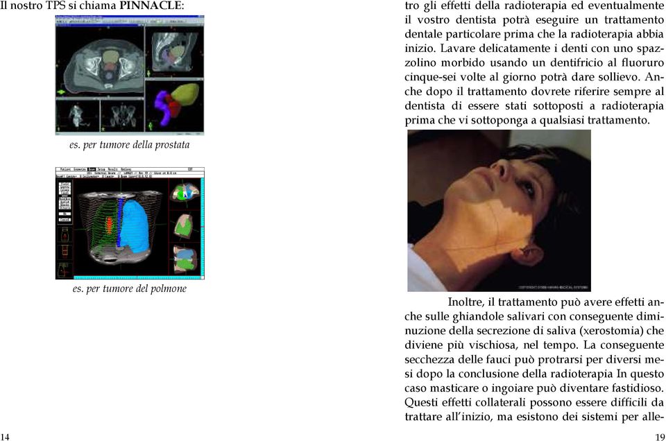 Anche dopo il trattamento dovrete riferire sempre al dentista di essere stati sottoposti a radioterapia prima che vi sottoponga a qualsiasi trattamento. es. per tumore della prostata es.