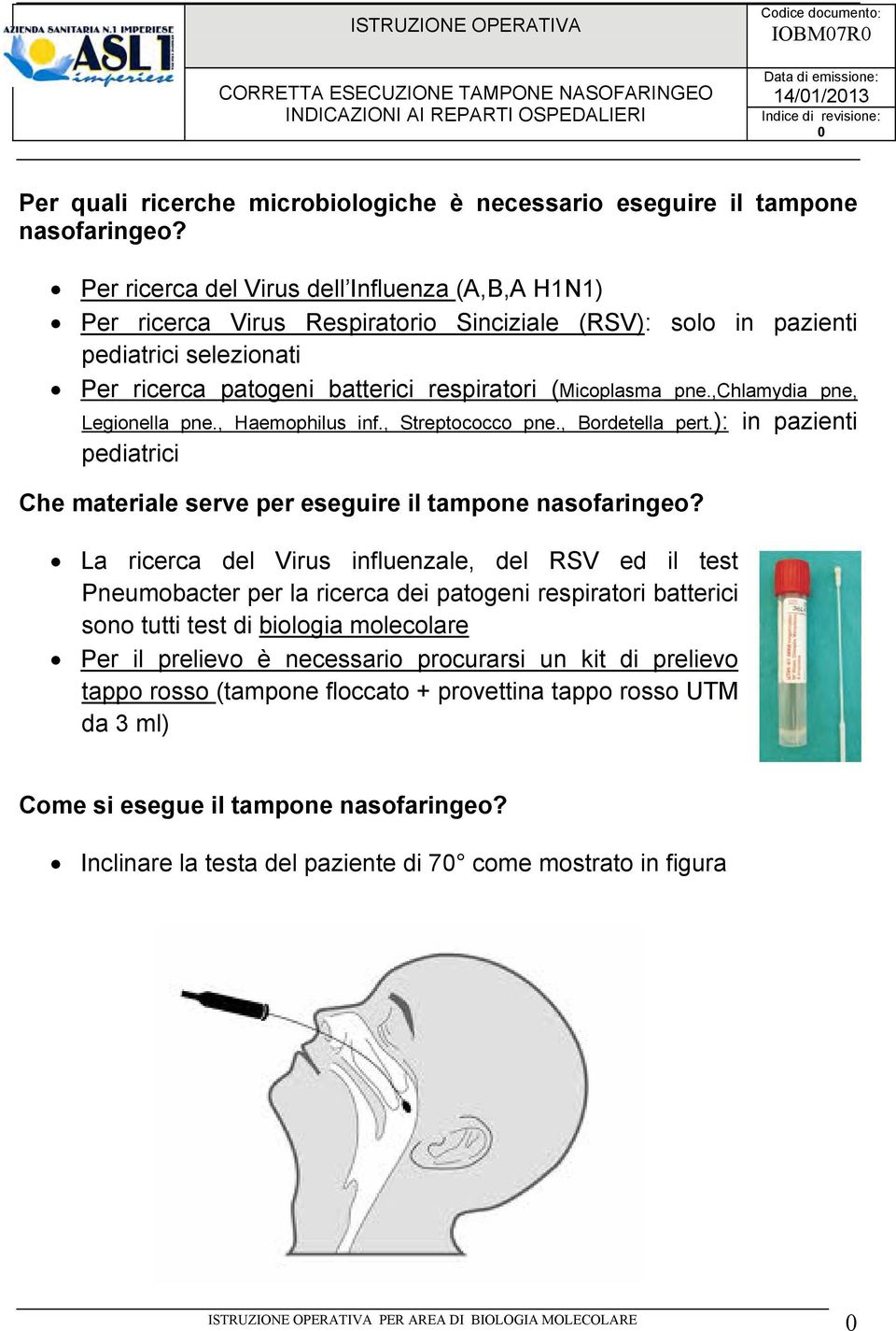 ,chlamydia pne, Legionella pne., Haemophilus inf., Streptococco pne., Bordetella pert.): in pazienti pediatrici Che materiale serve per eseguire il tampone nasofaringeo?