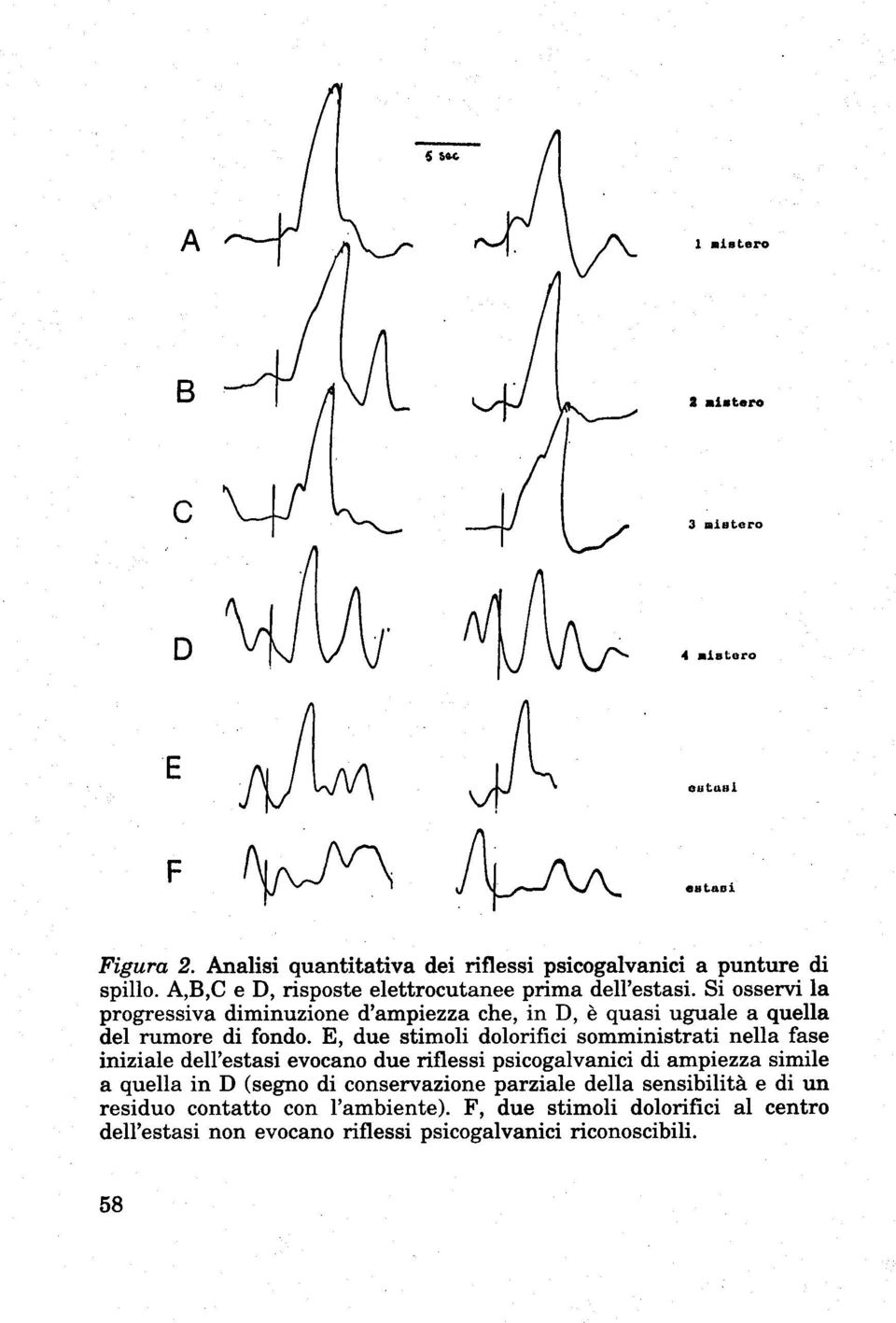 E, due stimoli dolorifici somministrati nella fase iniziale dell'estasi evocano due riflessi psicogalvanici di ampiezza simile a quella in D (segno di