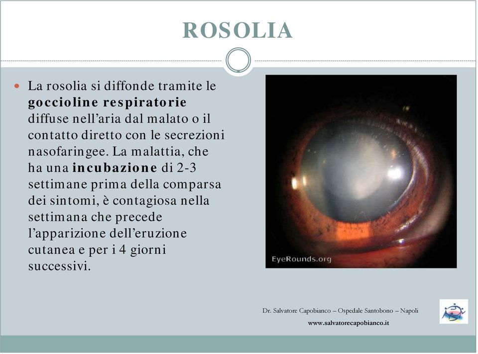 La malattia, che ha una incubazione di 2-3 settimane prima della comparsa dei