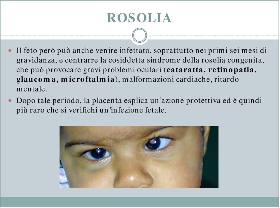 (cataratta, retinopatia, glaucoma, microftalmia), malformazioni cardiache, ritardo mentale.