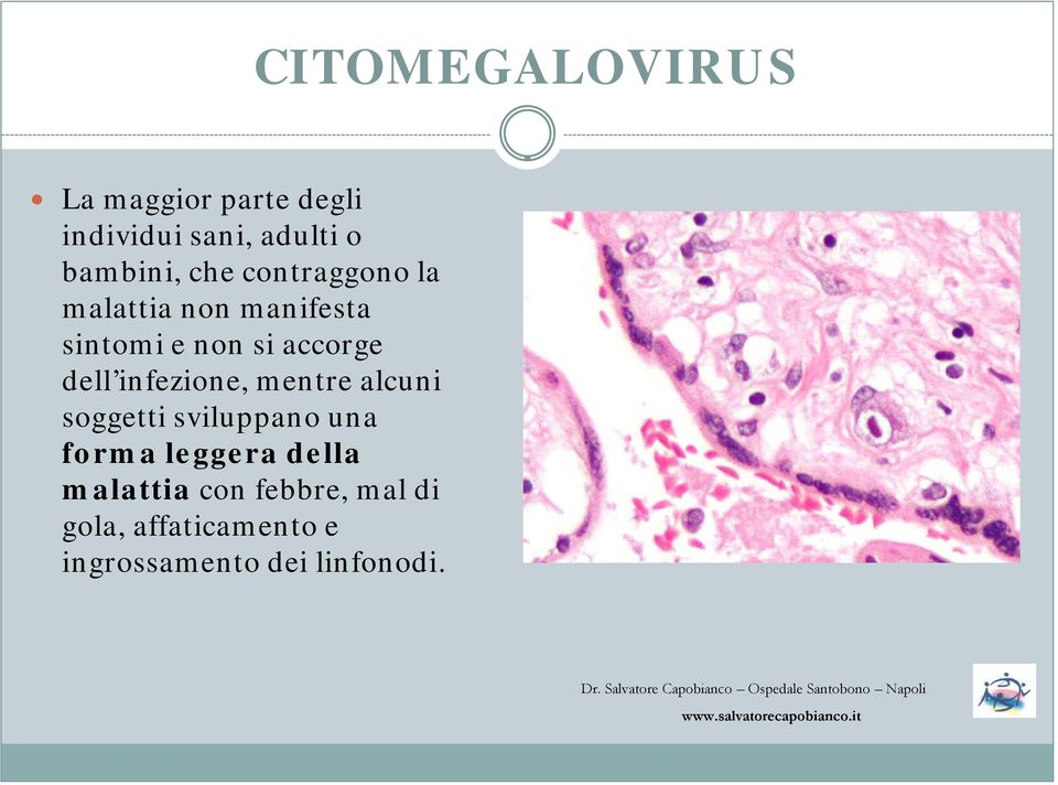 infezione, mentre alcuni soggetti sviluppano una forma leggera della