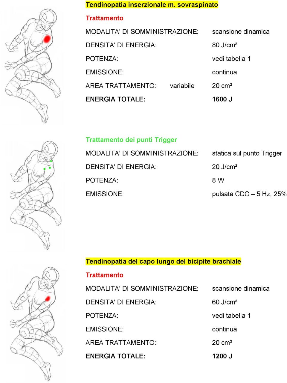 Trattamento dei punti Trigger statica sul punto Trigger 20 J/cm²