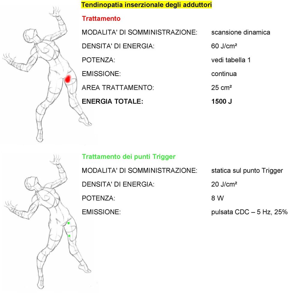 Trattamento dei punti Trigger statica sul