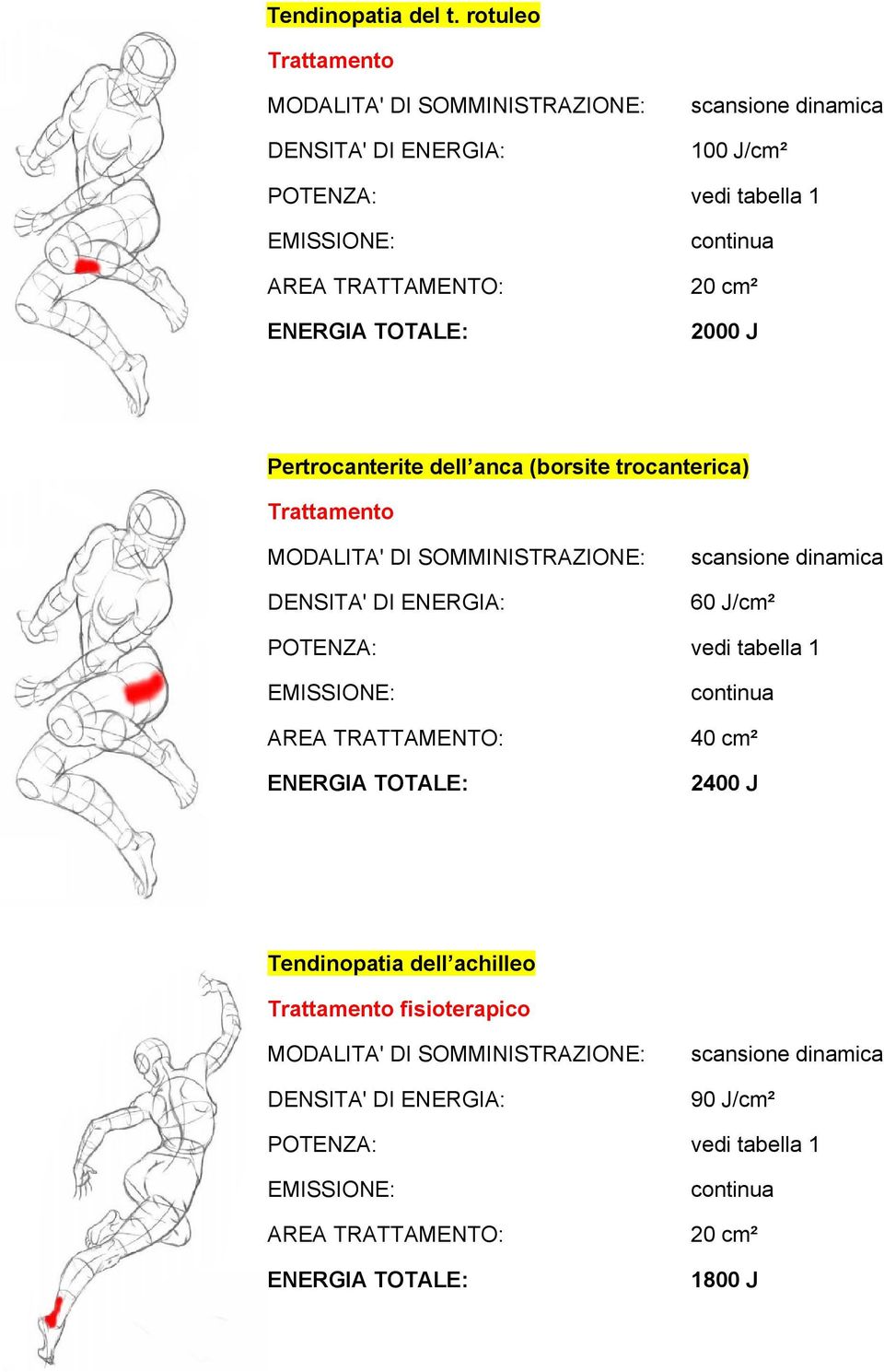 Pertrocanterite dell anca (borsite trocanterica)