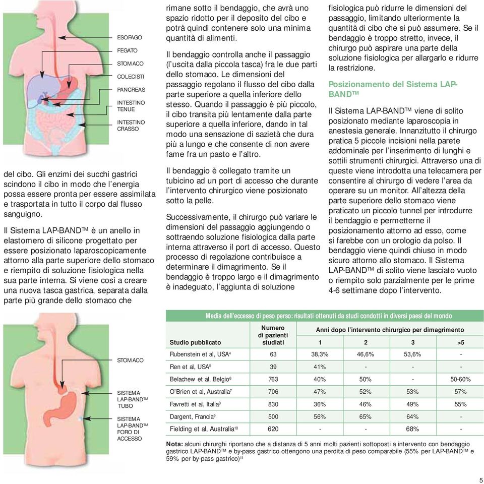 Il Sistema LAP-BAND TM è un anello in elastomero di silicone progettato per essere posizionato laparoscopicamente attorno alla parte superiore dello stomaco e riempito di soluzione fisiologica nella