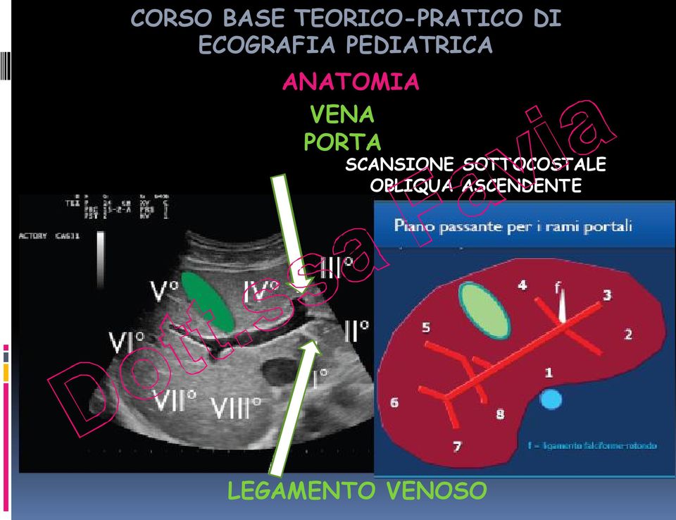 VENA PORTA SCANSIONE