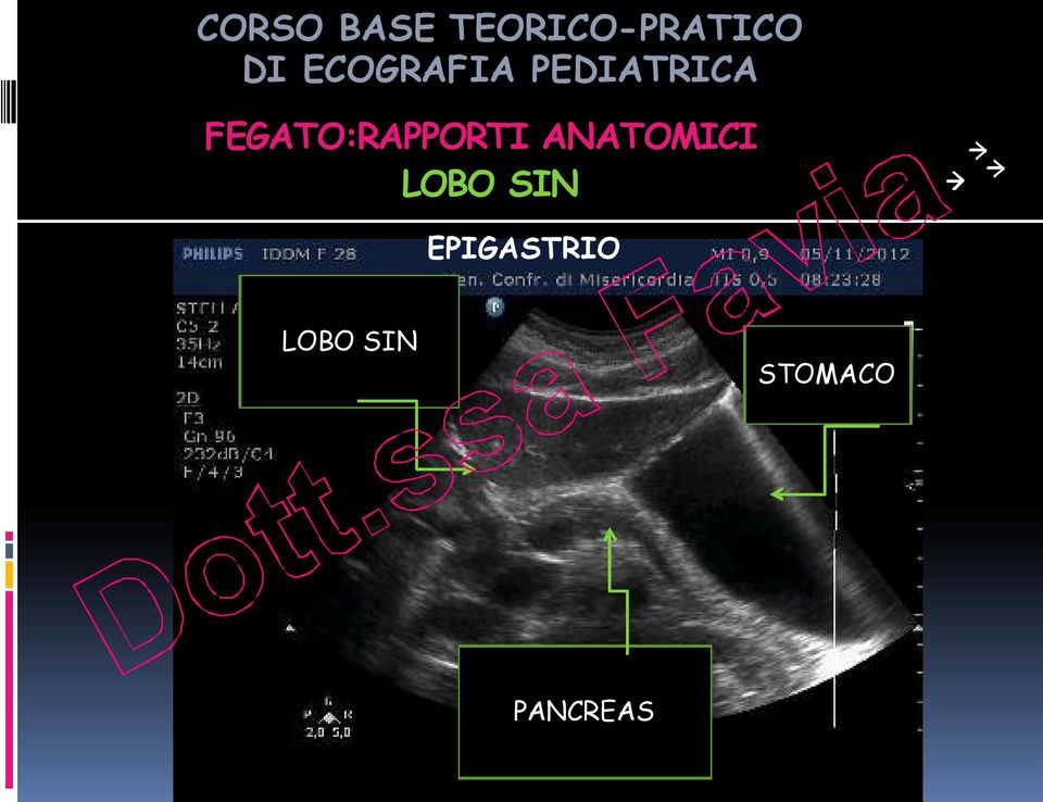 FEGATO:RAPPORTI ANATOMICI LOBO