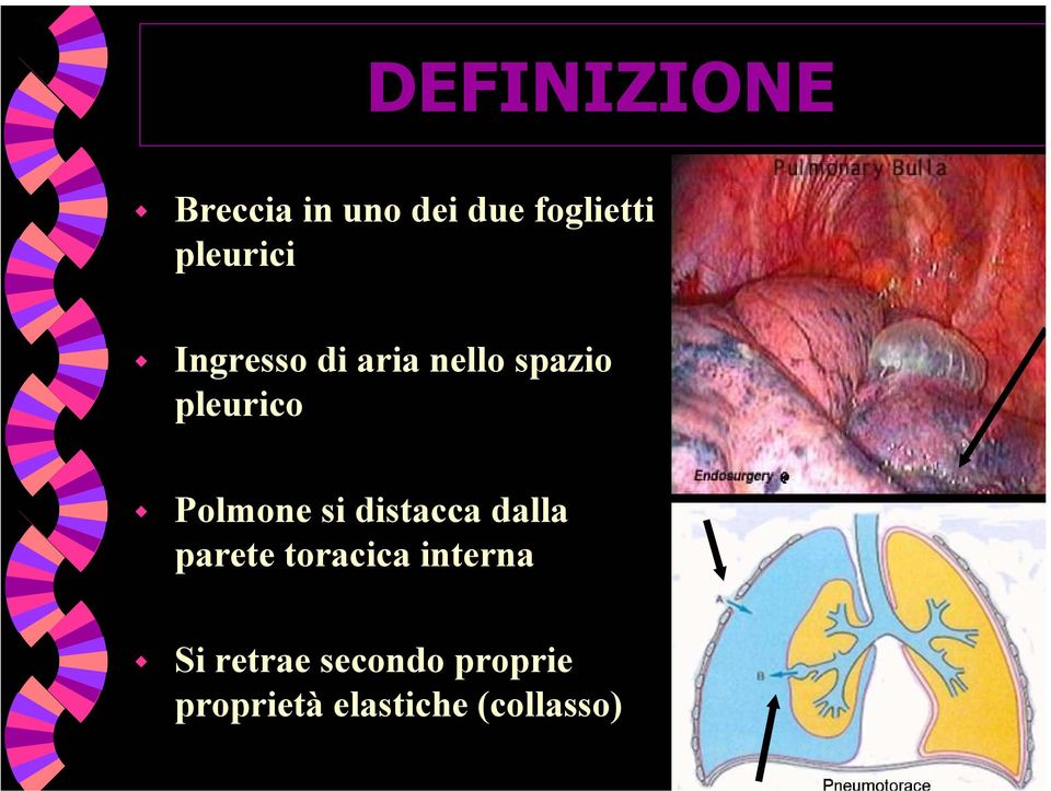 Polmone si distacca dalla parete toracica interna