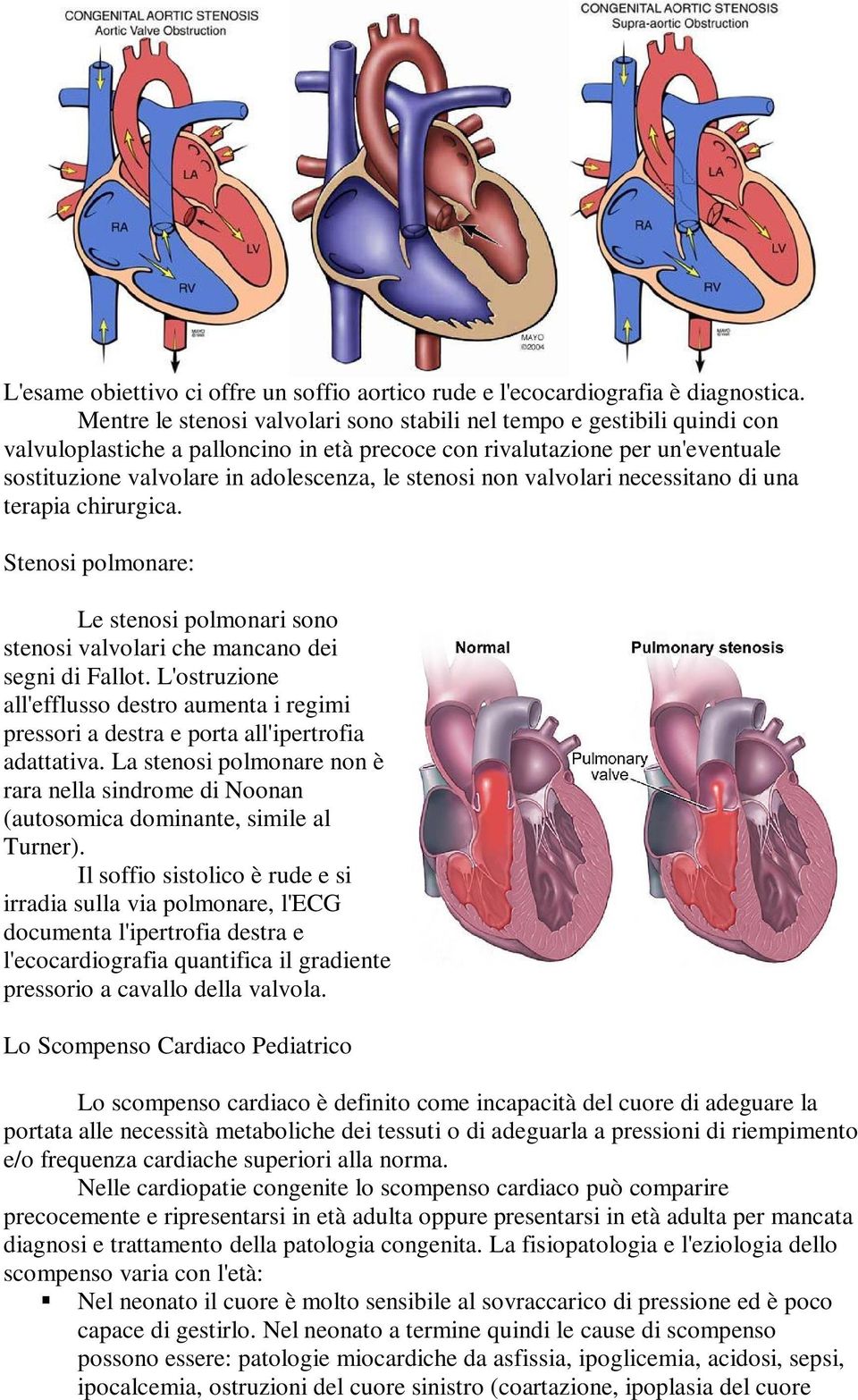 stenosi non valvolari necessitano di una terapia chirurgica. Stenosi polmonare: Le stenosi polmonari sono stenosi valvolari che mancano dei segni di Fallot.