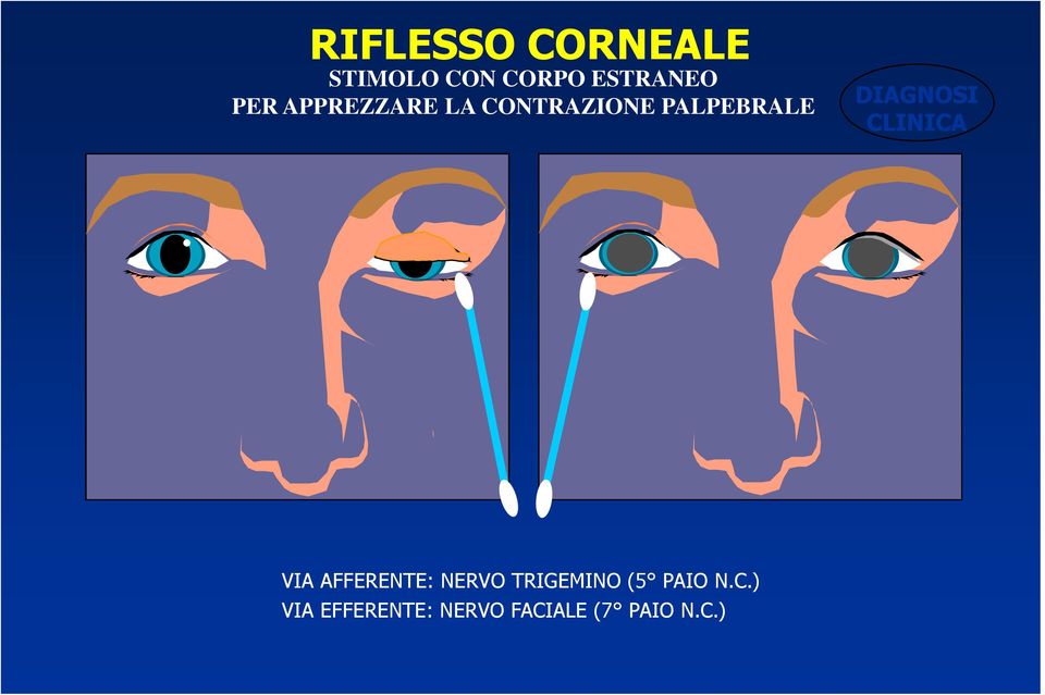 DIAGNOSI CLINICA VIA AFFERENTE: NERVO TRIGEMINO