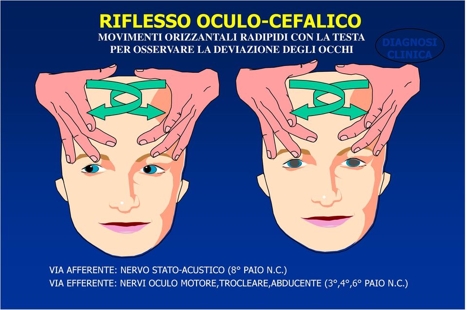 CLINICA VIA AFFERENTE: NERVO STATO-ACUSTICO (8 PAIO N.C.) VIA