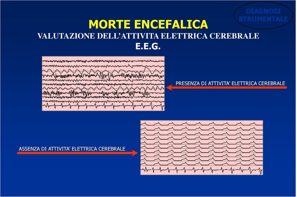 DIAGNOSI STRUMENTALE PRESENZA DI ATTIVITA