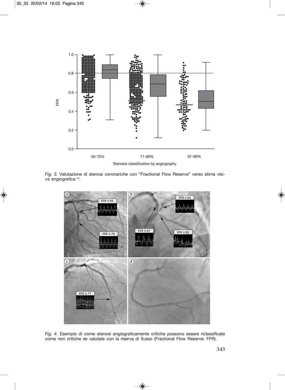 Valutazione di stenosi coronariche con Fractional Flow Reserve verso stima visiva angiografica 14.