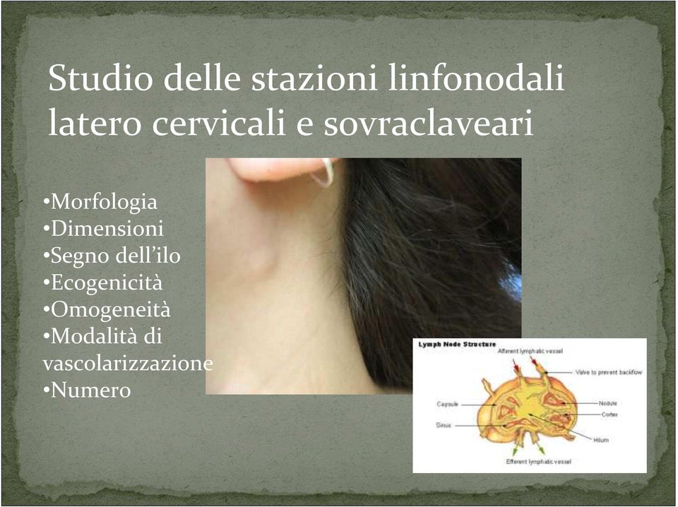 Dimensioni Segno dell ilo Ecogenicità