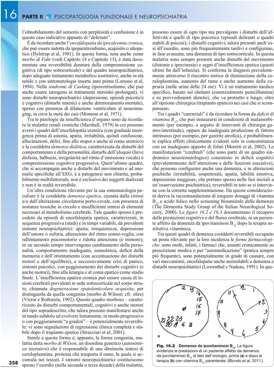 In questa forma, nota anche come morbo di Fahr (vedi Capitolo 14 e Capitolo 15), è stata documentata una reversibilità duratura della compromissione cognitiva (di tipo sottocorticale) e del quadro