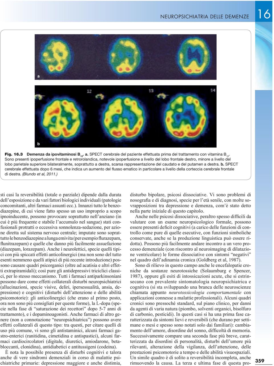 Anche nelle psicosi dissociative, peraltro spesso difficili da valutare con un esame neuropsicologico formale, possono essere presenti deficit cognitivi (a carico delle funzioni di controllo come