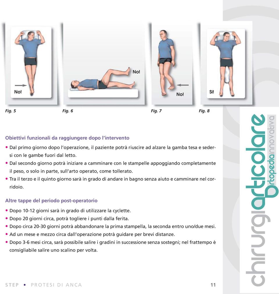 Dal secondo giorno potrà iniziare a camminare con le stampelle appoggiando completamente il peso, o solo in parte, sull arto operato, come tollerato.