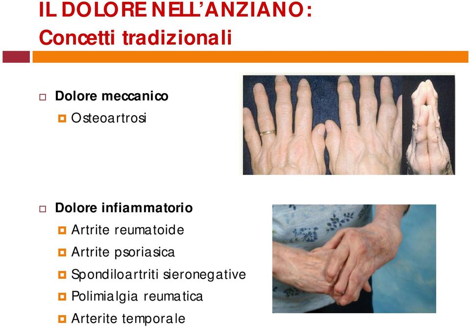 Artrite reumatoide Artrite psoriasica