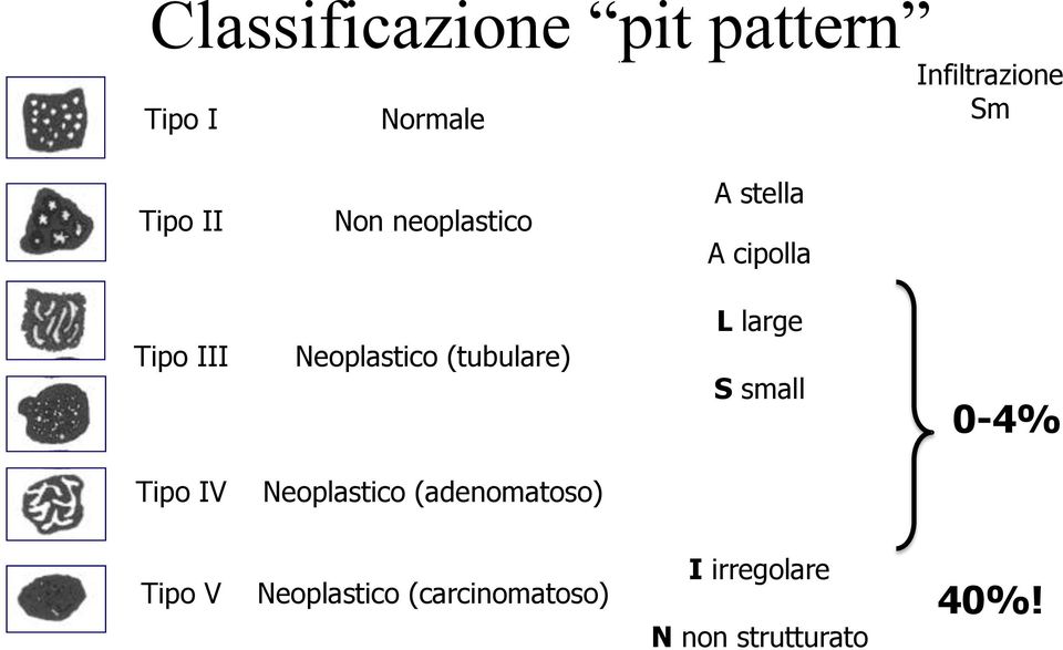 (tubulare) L large S small 0-4% Tipo IV Neoplastico