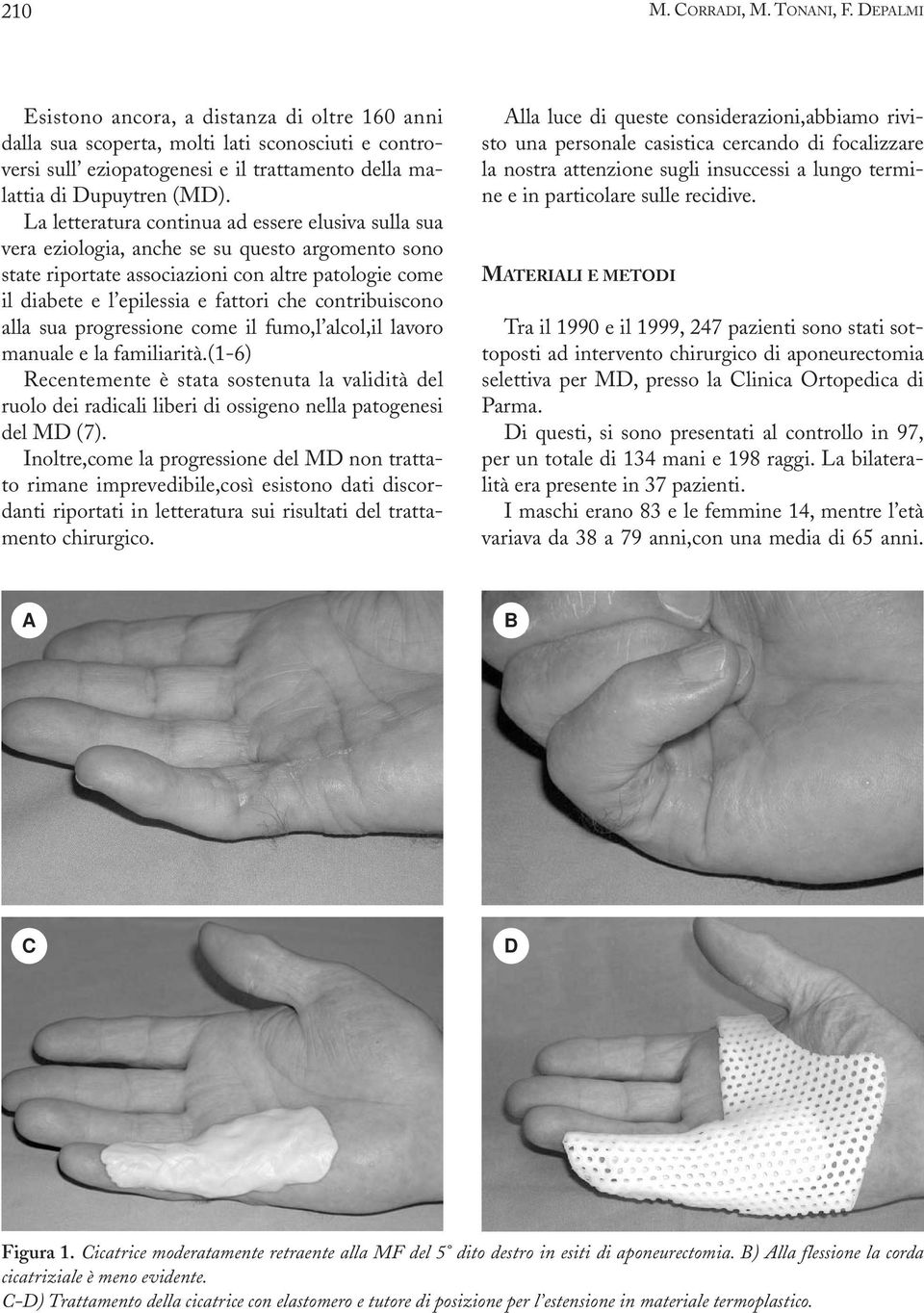 La letteratura continua ad essere elusiva sulla sua vera eziologia, anche se su questo argomento sono state riportate associazioni con altre patologie come il diabete e l epilessia e fattori che