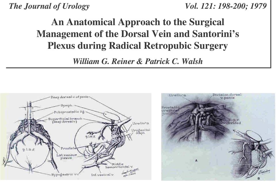 Surgical Management of the Dorsal Vein and Santorini