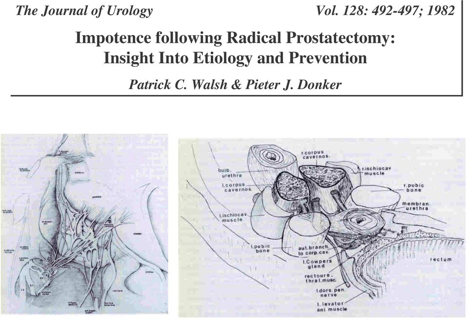 Radical Prostatectomy: Insight Into