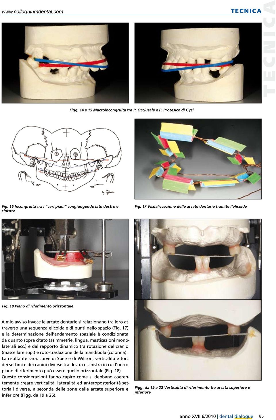 18 Piano di riferimento orizzontale A mio avviso invece le arcate dentarie si relazionano tra loro attraverso una sequenza elicoidale di punti nello spazio (Fig.