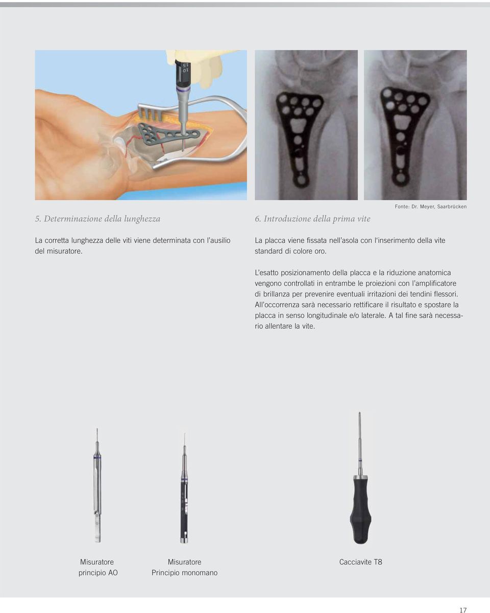 La placca viene fissata nell asola con l inserimento della vite standard di colore oro.