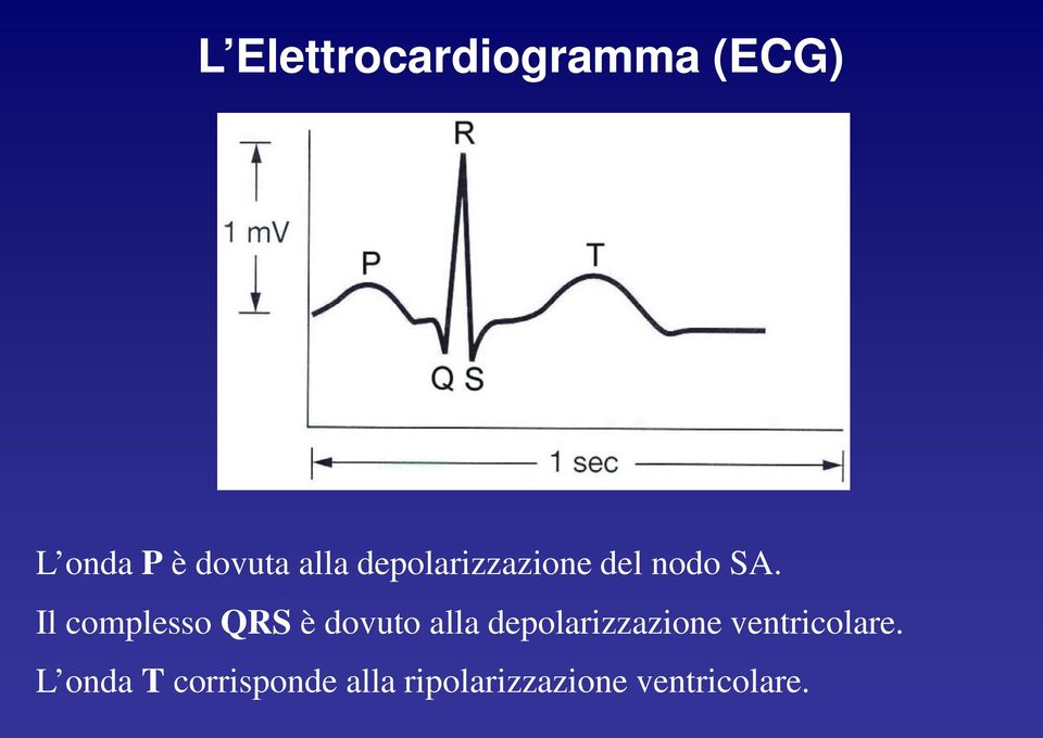 Il complesso QRS è dovuto alla depolarizzazione