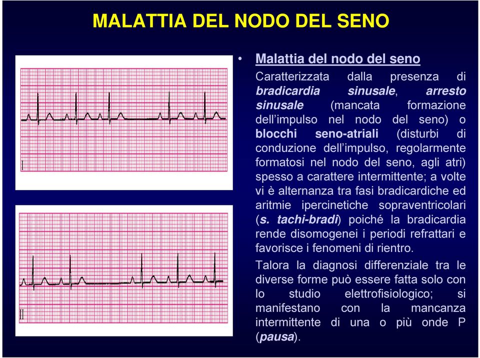 fasi bradicardiche ed aritmie ipercinetiche sopraventricolari (s. tachi-bradi) poiché la bradicardia rende disomogenei i periodi refrattari e favorisce i fenomeni di rientro.