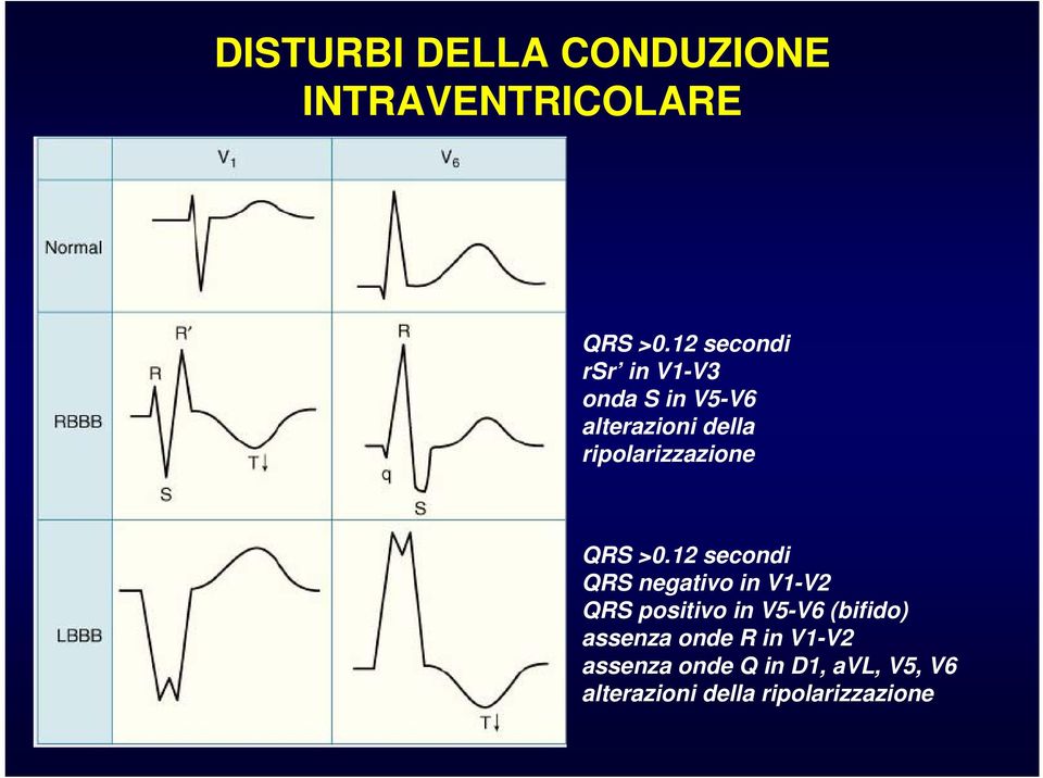 ripolarizzazione QRS >0.