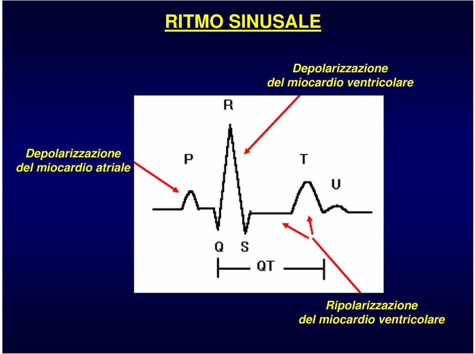 Depolarizzazione del miocardio