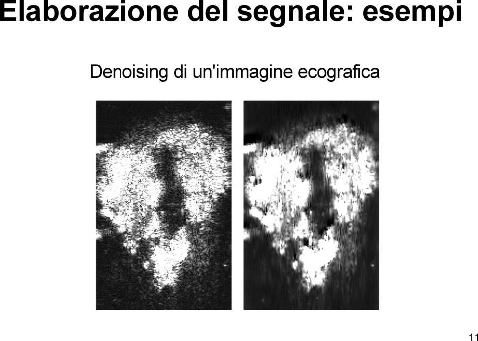 Denoising di