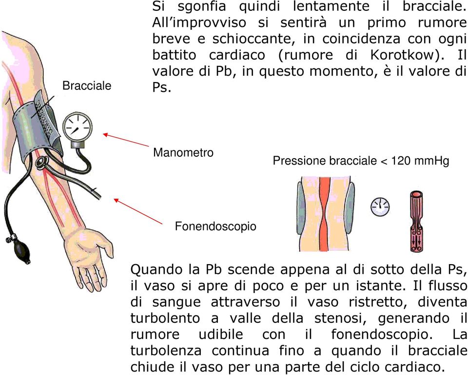 Il valore di Pb, in questo momento, è il valore di Ps.