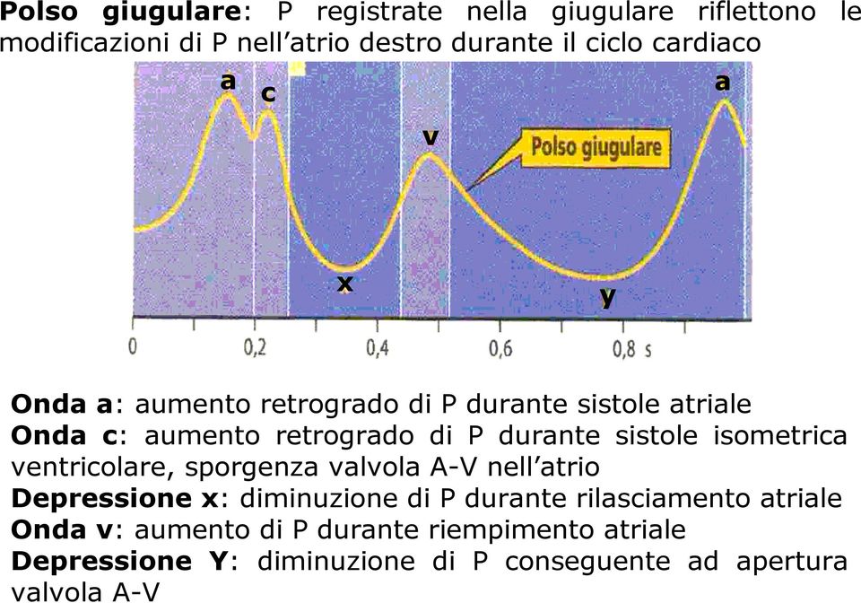sistole isometrica ventricolare, sporgenza valvola A-V nell atrio Depressione x: diminuzione di P durante