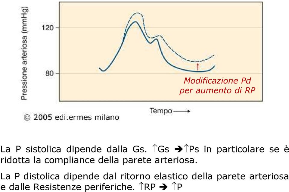 Gs Ps in particolare se è ridotta la compliance della parete