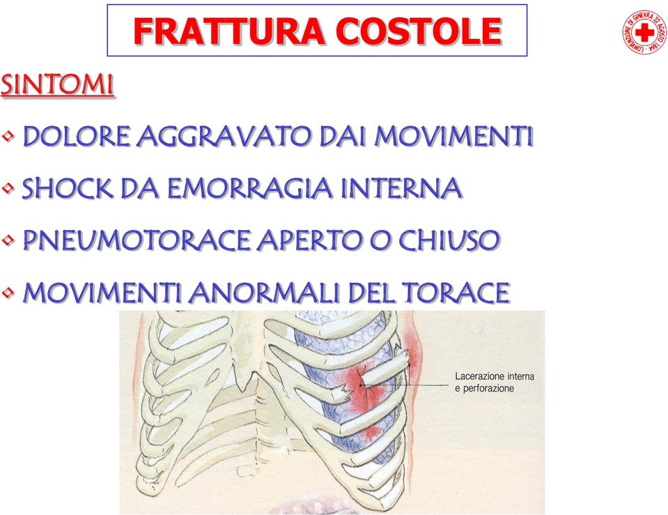 EMORRAGIA INTERNA PNEUMOTORACE